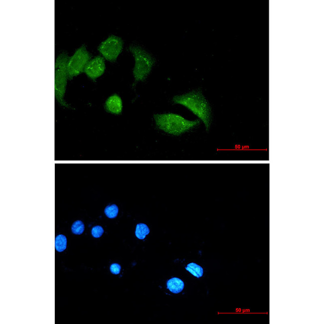 UBE4B Antibody in Immunocytochemistry (ICC/IF)