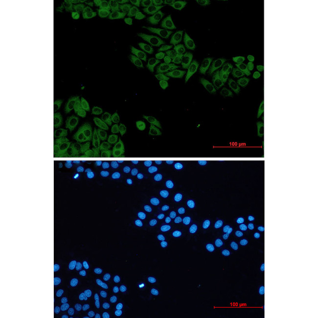 VAV2 Antibody in Immunocytochemistry (ICC/IF)