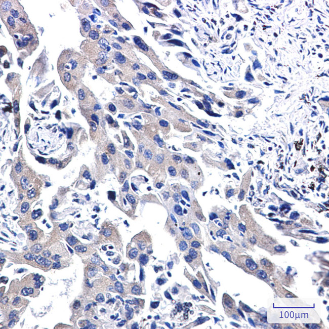 WWOX Antibody in Immunohistochemistry (Paraffin) (IHC (P))