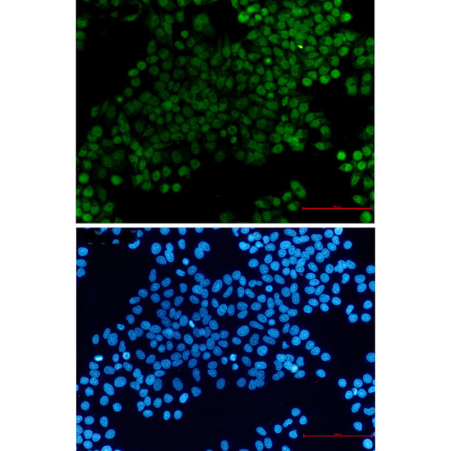 XRCC1 Antibody in Immunocytochemistry (ICC/IF)