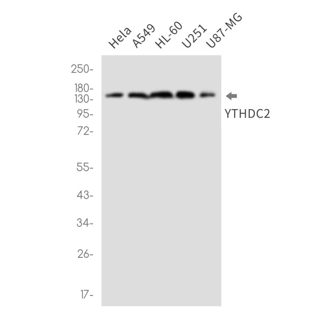 YTHDC2 Antibody in Western Blot (WB)