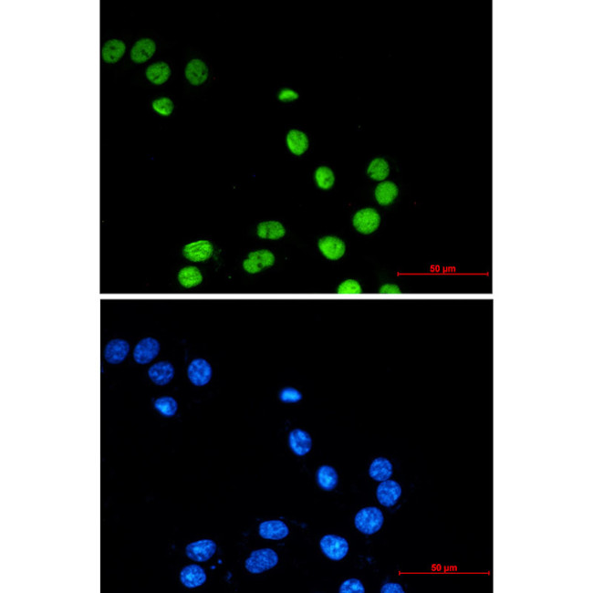 Pokemon Antibody in Immunocytochemistry (ICC/IF)