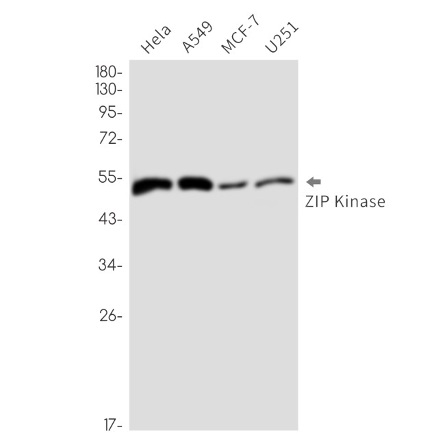 ZIPK Antibody in Western Blot (WB)