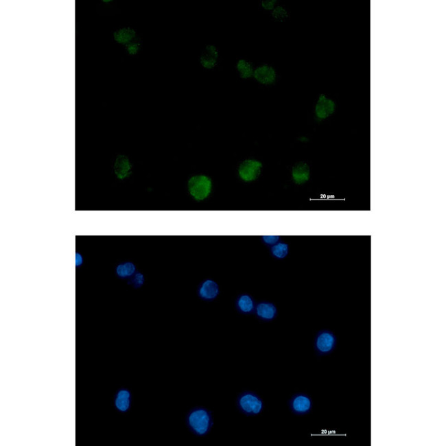 PKC beta Antibody in Immunocytochemistry (ICC/IF)