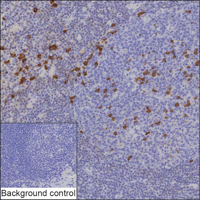 Human IgG4 Antibody in Immunohistochemistry (Paraffin) (IHC (P))