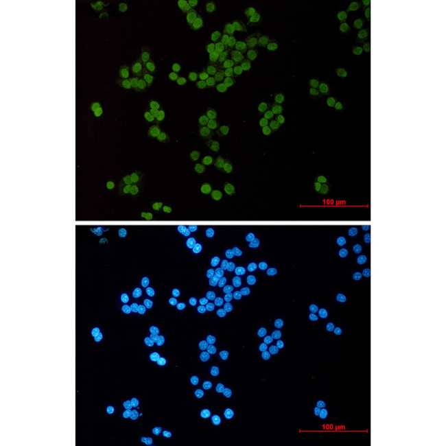 H3K14ac Antibody in Immunocytochemistry (ICC/IF)