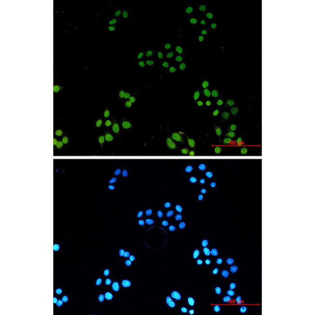 H3K4ac Antibody in Immunocytochemistry (ICC/IF)