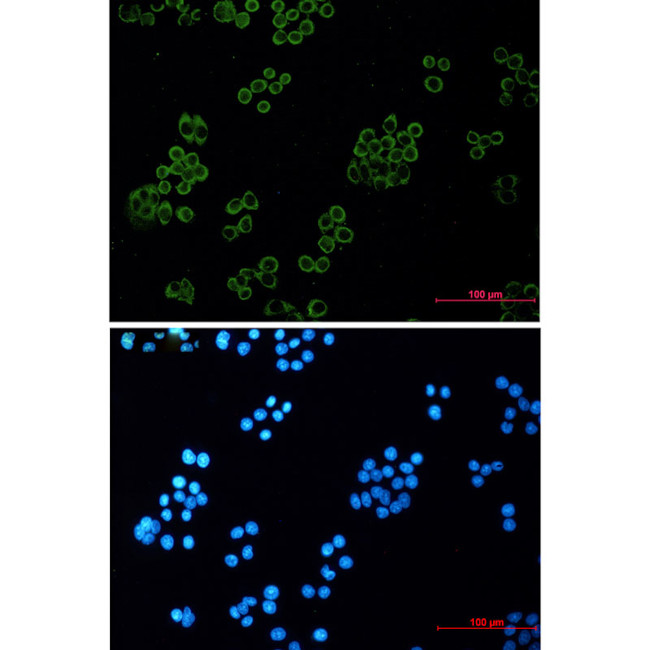 Kappa Light Chain Antibody in Immunocytochemistry (ICC/IF)