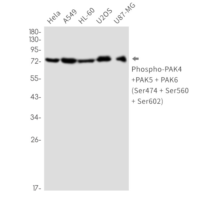 Phospho-PAK4/6/7 (Ser474, Ser560, Ser602) Antibody in Western Blot (WB)