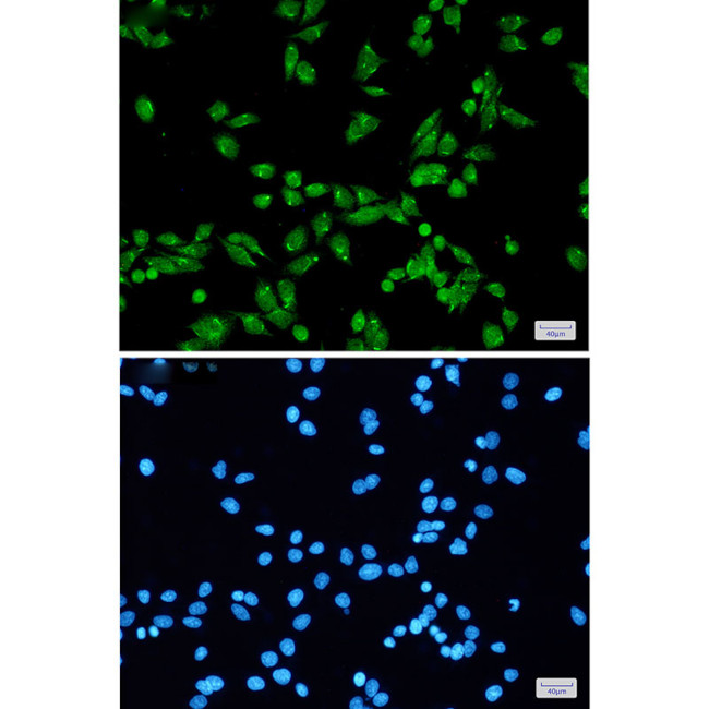 PRPF31 Antibody in Immunocytochemistry (ICC/IF)