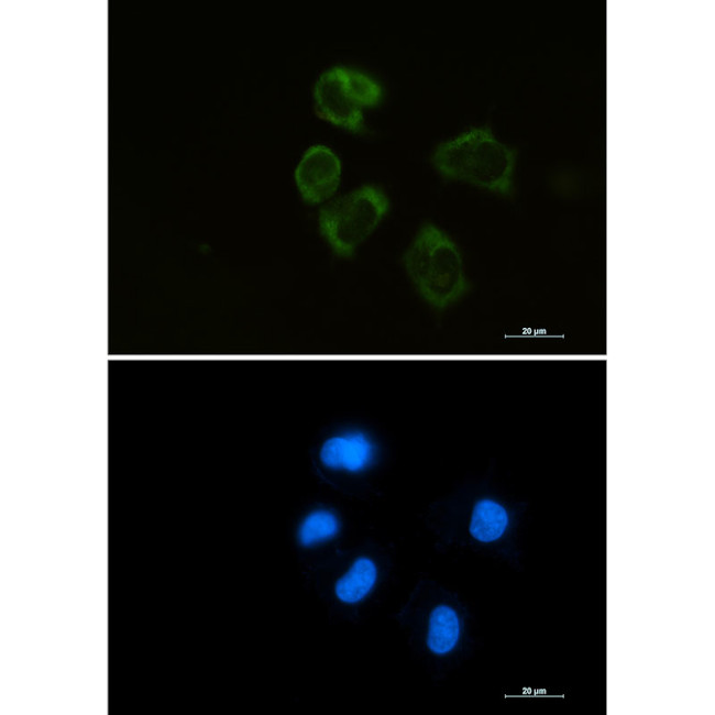 Lysozyme Antibody in Immunocytochemistry (ICC/IF)