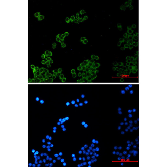 PLAA Antibody in Immunocytochemistry (ICC/IF)