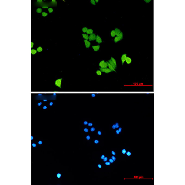 PLK1 Antibody in Immunocytochemistry (ICC/IF)