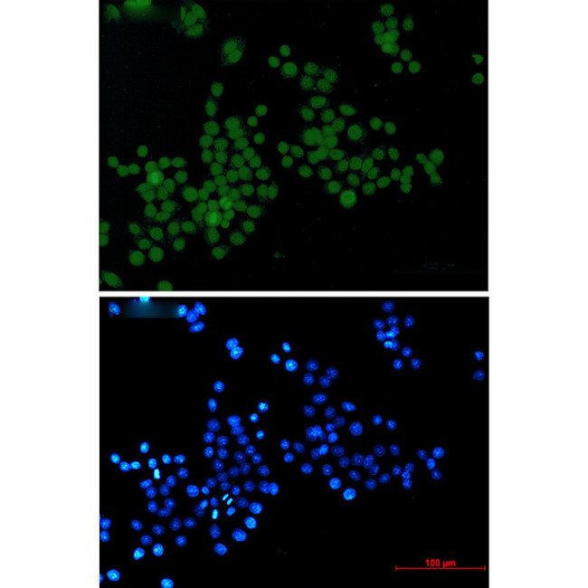 Phospho-Histone H3 (Ser10, Thr11) Antibody in Immunocytochemistry (ICC/IF)