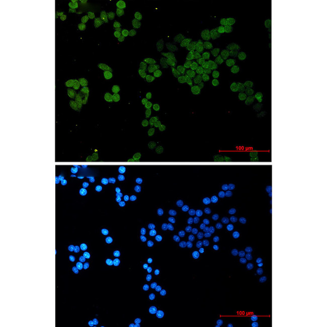 CRCP Antibody in Immunocytochemistry (ICC/IF)