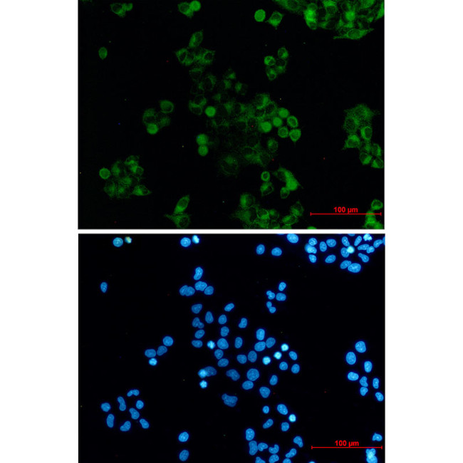 DAB2 Antibody in Immunocytochemistry (ICC/IF)