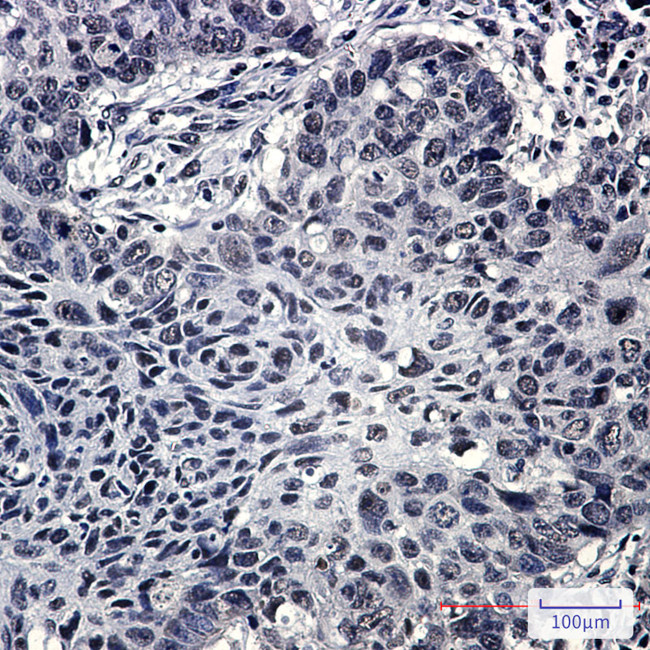 SRSF3 Antibody in Immunohistochemistry (Paraffin) (IHC (P))
