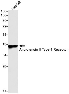 AGTR1 Antibody in Western Blot (WB)