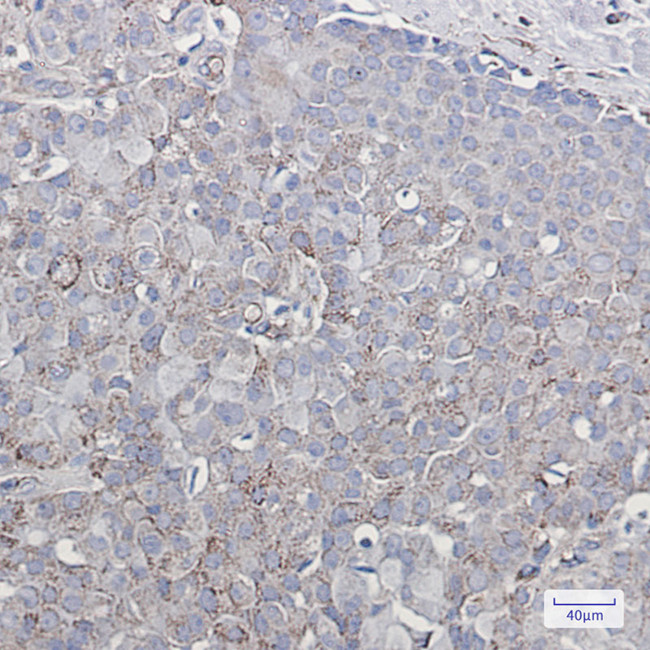 GluR2 Antibody in Immunohistochemistry (Paraffin) (IHC (P))