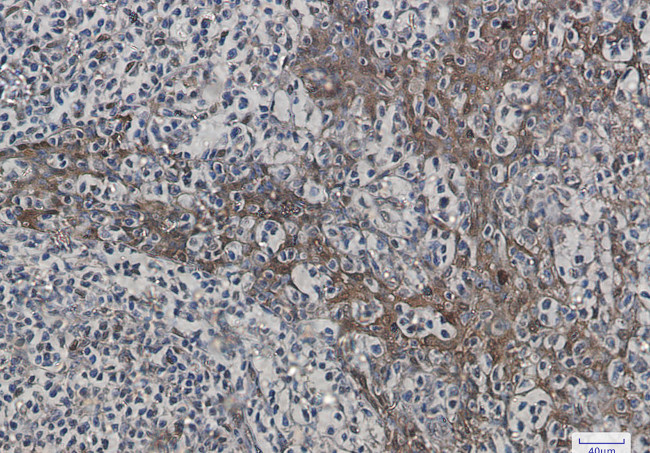 HSPA1B Antibody in Immunohistochemistry (Paraffin) (IHC (P))