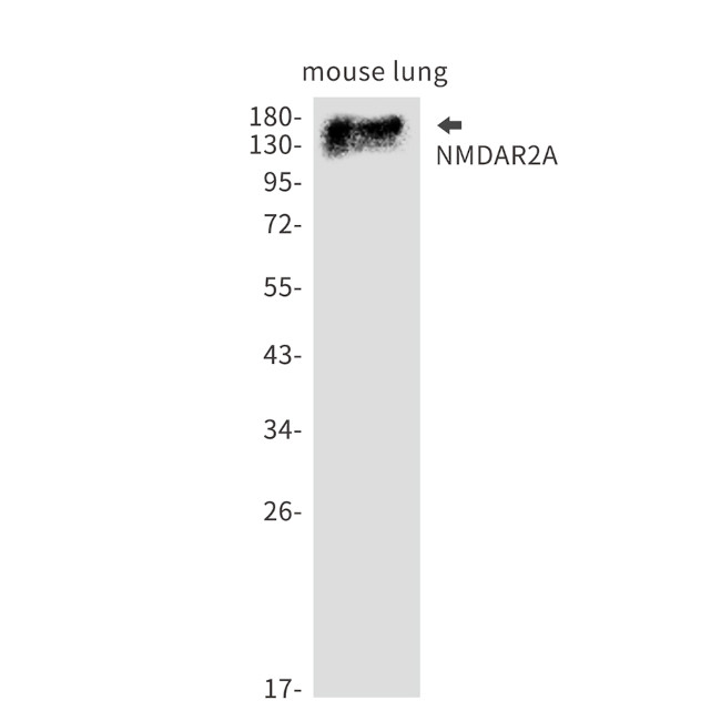 NMDAR2A Antibody in Western Blot (WB)