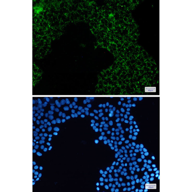 PDHA1 Antibody in Immunocytochemistry (ICC/IF)