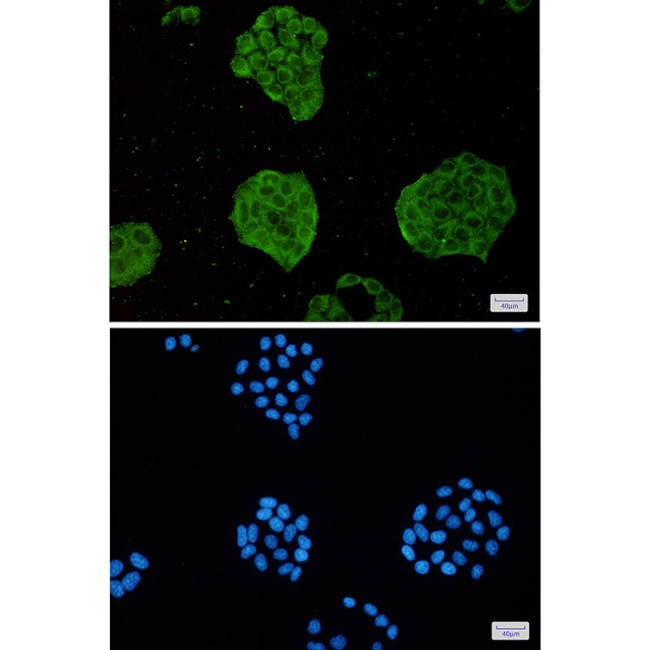 TRIM56 Antibody in Immunocytochemistry (ICC/IF)