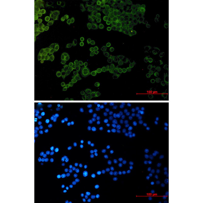 COL1A1 Antibody in Immunocytochemistry (ICC/IF)