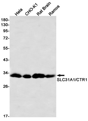 CTR1 Antibody in Western Blot (WB)