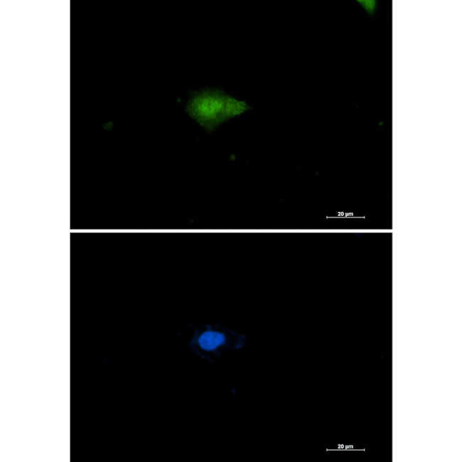 NAMPT Antibody in Immunocytochemistry (ICC/IF)