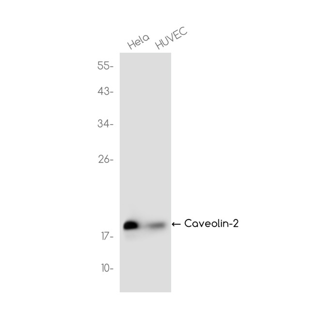 Caveolin 2 Antibody in Western Blot (WB)