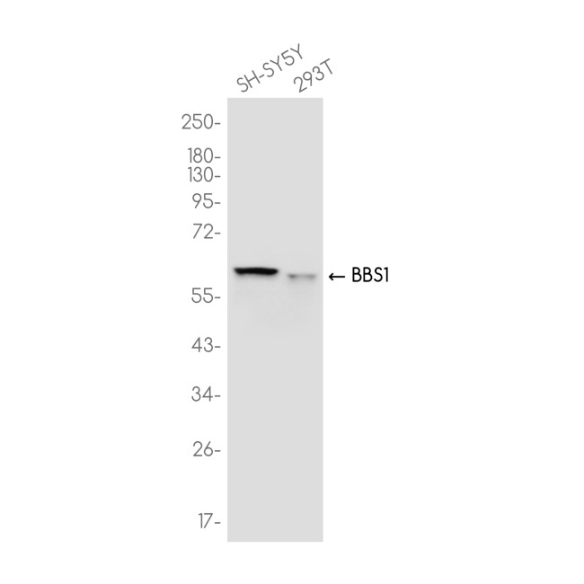 BBS1 Antibody in Western Blot (WB)