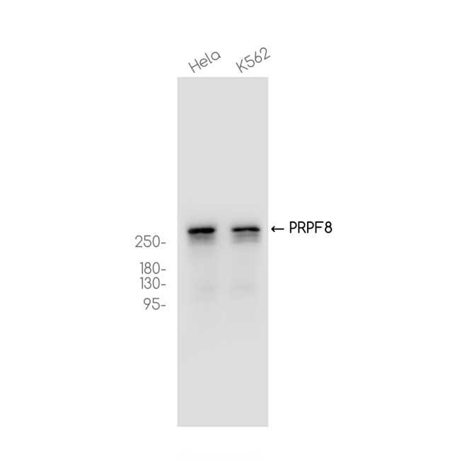 PRP8 Antibody in Western Blot (WB)