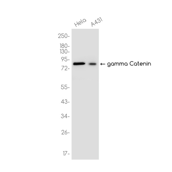 gamma Catenin Antibody in Western Blot (WB)