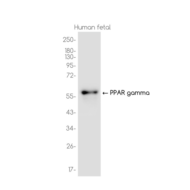 PPAR gamma Antibody in Western Blot (WB)