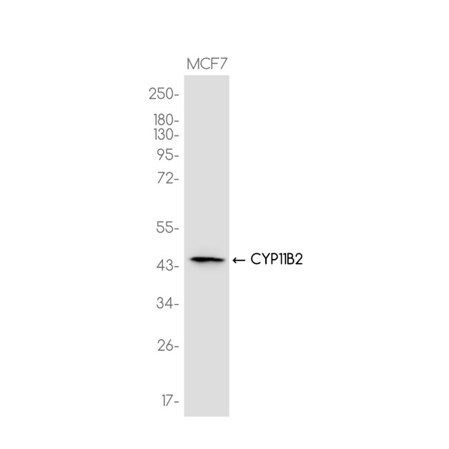 CYP11B2 Antibody in Western Blot (WB)