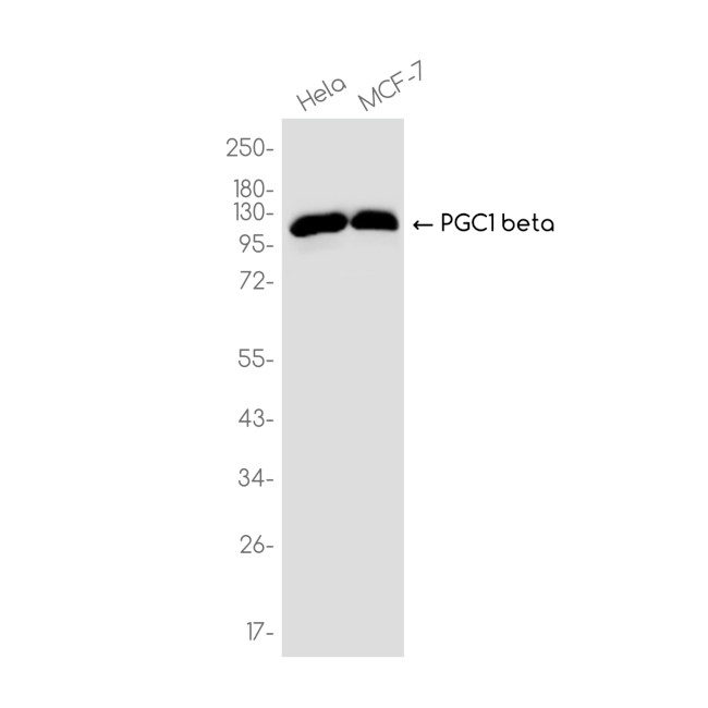 PPARGC1B Antibody in Western Blot (WB)