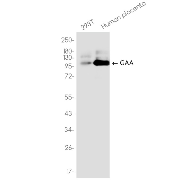 GAA Antibody in Western Blot (WB)