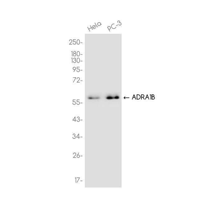 alpha-1b Adrenergic Receptor Antibody in Western Blot (WB)