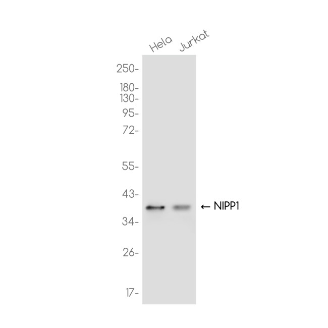 PPP1R8 Antibody in Western Blot (WB)