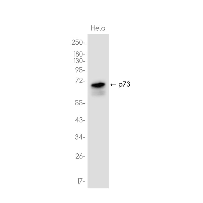 p73 Antibody in Western Blot (WB)
