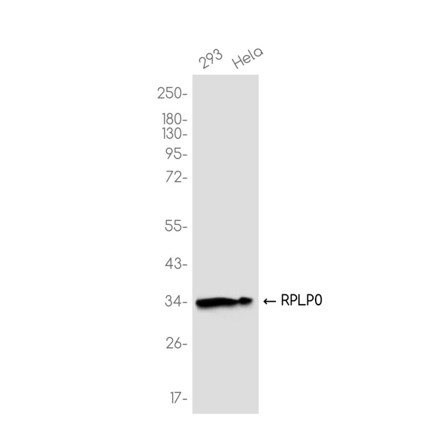 RPLP0 Antibody in Western Blot (WB)