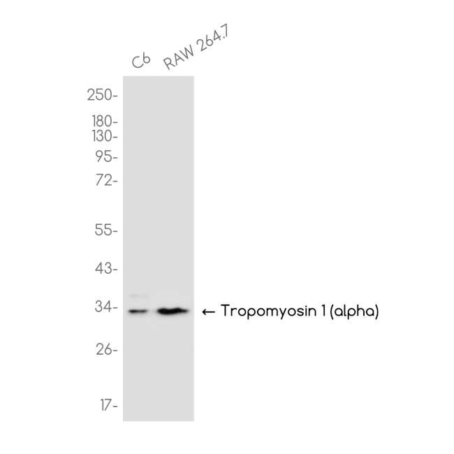 TPM1 Antibody in Western Blot (WB)