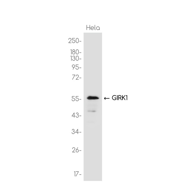 Kir3.1 (KCNJ3) Antibody in Western Blot (WB)