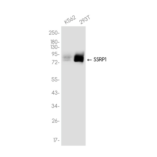SSRP1 Antibody in Western Blot (WB)