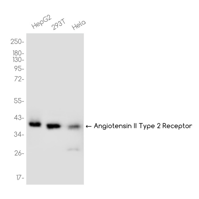 AGTR2 Antibody in Western Blot (WB)