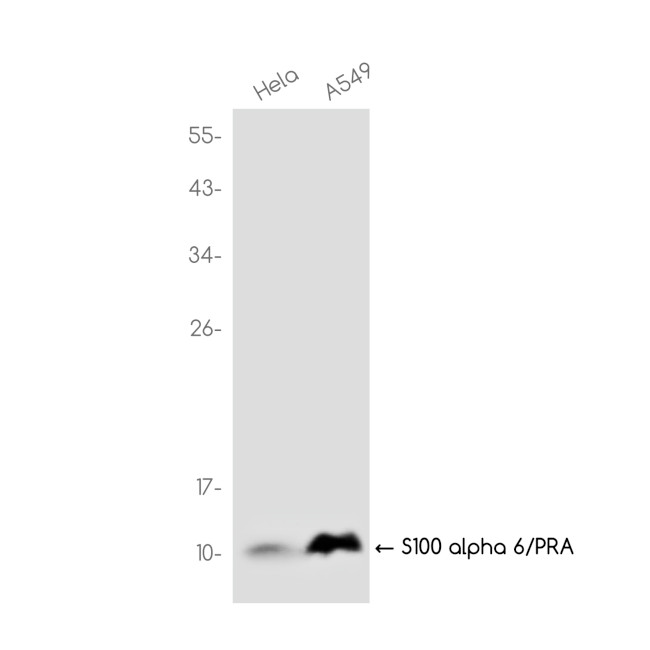 S100A6 Antibody in Western Blot (WB)