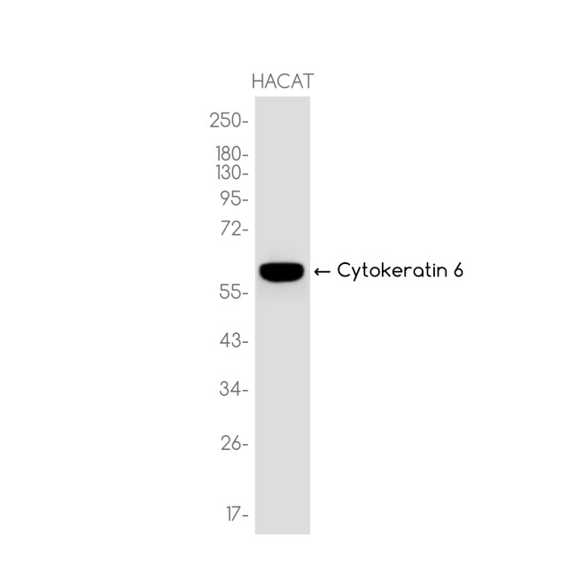 Cytokeratin 6 Antibody in Western Blot (WB)