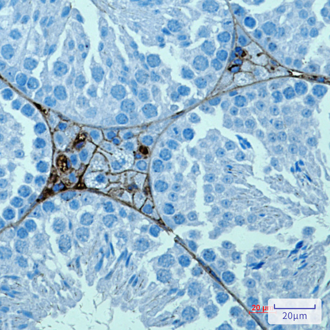PRAME Antibody in Immunohistochemistry (Paraffin) (IHC (P))