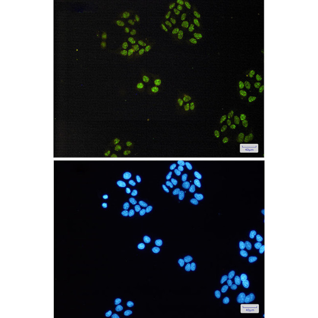 TAF15 Antibody in Immunocytochemistry (ICC/IF)
